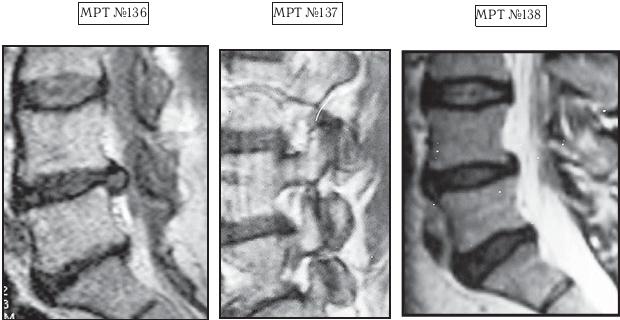 Остеохондроз для профессионального пациента Остеохондроз для профессионального пациента