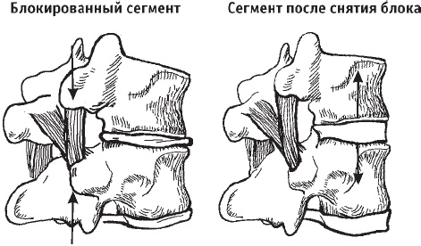 Первая скрипка позвоночника. Революционная методика лечения остеохондроза Первая скрипка позвоночника. Революционная методика лечения остеохондроза