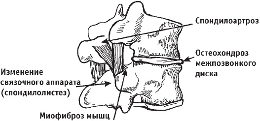 Первая скрипка позвоночника. Революционная методика лечения остеохондроза Первая скрипка позвоночника. Революционная методика лечения остеохондроза