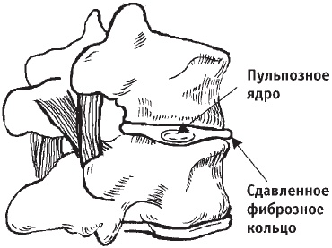 Первая скрипка позвоночника. Революционная методика лечения остеохондроза Первая скрипка позвоночника. Революционная методика лечения остеохондроза