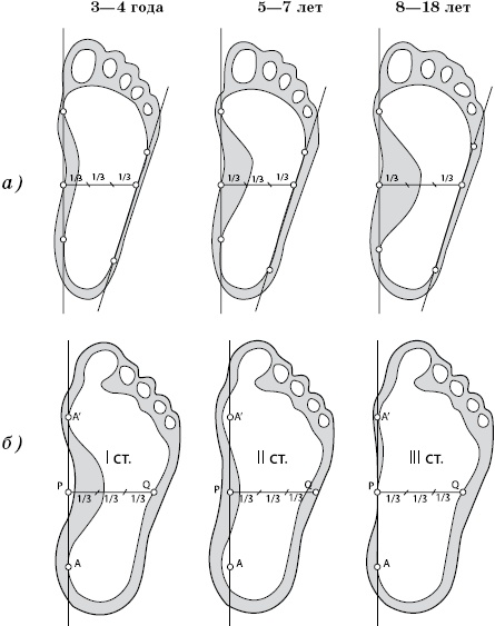 Плоскостопие. Самые эффективные методы лечения Плоскостопие. Самые эффективные методы лечения