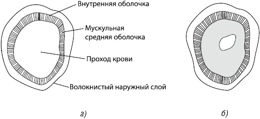 Здоровое сердце Здоровое сердце