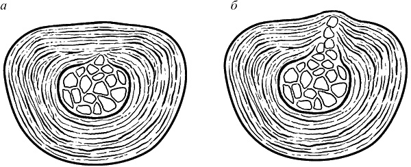 Здоровье вашего позвоночника Здоровье вашего позвоночника