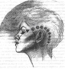 Энергетическая медицина Энергетическая медицина