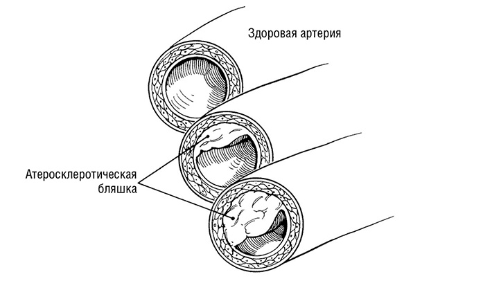 Здоровое сердце. Издание XXI века Здоровое сердце. Издание XXI века