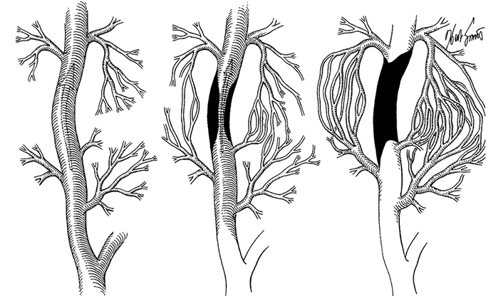 Здоровое сердце. Издание XXI века Здоровое сердце. Издание XXI века