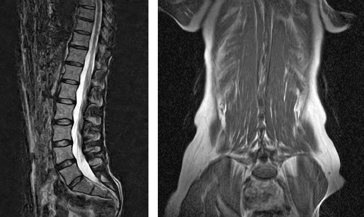 Йога при остеопорозе Йога при остеопорозе