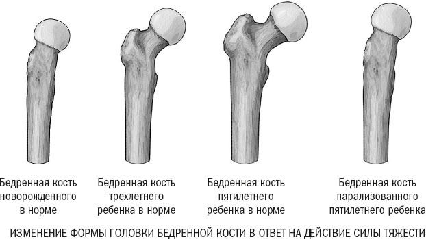 Йога при остеопорозе Йога при остеопорозе