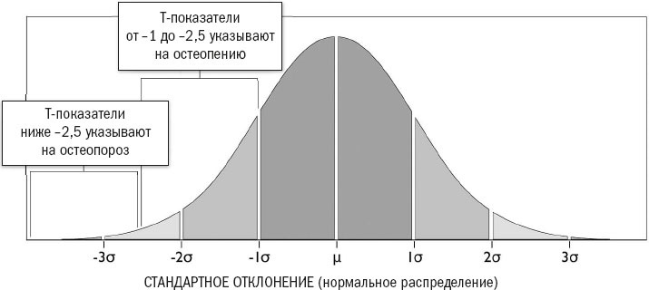 Йога при остеопорозе Йога при остеопорозе