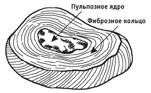 Грыжа позвоночника. Безоперационное лечение и профилактика Грыжа позвоночника. Безоперационное лечение и профилактика