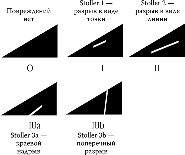 Как лечить спину и суставы Как лечить спину и суставы