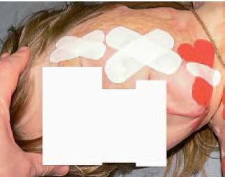 Кинезиотейпинг в лечебной практике неврологии и ортопедии Кинезиотейпинг в лечебной практике неврологии и ортопедии