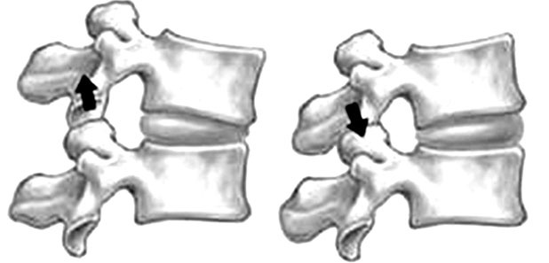 Здоровый позвоночник Здоровый позвоночник
