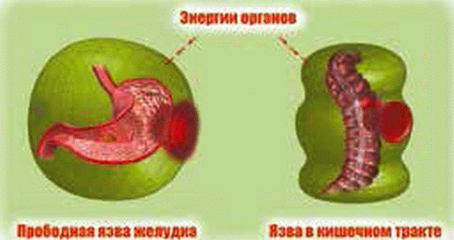 Энергетическое исцеление матрицами Энергетическое исцеление матрицами