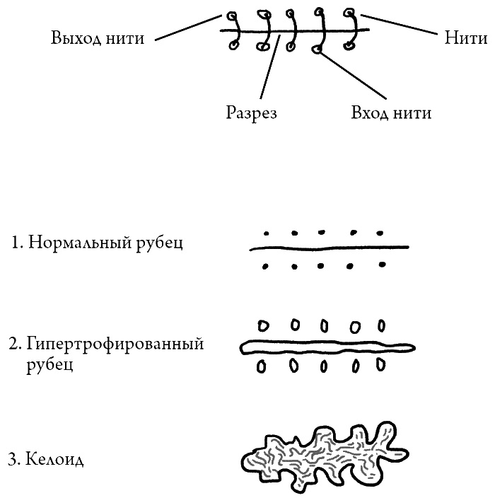 Что скрывает кожа. 2 квадратных метра, которые диктуют, как нам жить Что скрывает кожа. 2 квадратных метра, которые диктуют, как нам жить