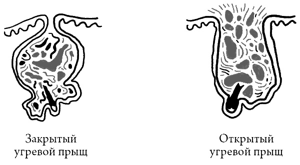 Что скрывает кожа. 2 квадратных метра, которые диктуют, как нам жить Что скрывает кожа. 2 квадратных метра, которые диктуют, как нам жить