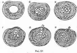 Победить боль в спине Победить боль в спине