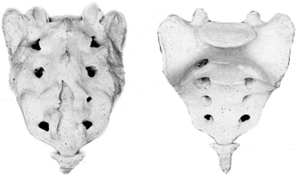 Чтобы спина не болела Чтобы спина не болела