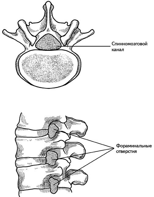 Жизнь без боли в спине. Лечение сколиоза, остеопороза, остеохондроза, межпозвонковой грыжи без операции Жизнь без боли в спине. Лечение сколиоза, остеопороза, остеохондроза, межпозвонковой грыжи без операции