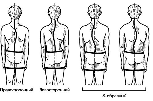 Жизнь без боли в спине. Лечение сколиоза, остеопороза, остеохондроза, межпозвонковой грыжи без операции Жизнь без боли в спине. Лечение сколиоза, остеопороза, остеохондроза, межпозвонковой грыжи без операции