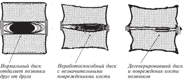 Как лечить боли в спине и ревматические боли в суставах Как лечить боли в спине и ревматические боли в суставах