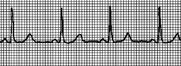 Стоп-инфаркт. Как читать ЭКГ и заботиться о сердце Стоп-инфаркт. Как читать ЭКГ и заботиться о сердце