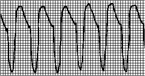 Стоп-инфаркт. Как читать ЭКГ и заботиться о сердце Стоп-инфаркт. Как читать ЭКГ и заботиться о сердце