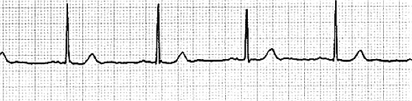 Стоп-инфаркт. Как читать ЭКГ и заботиться о сердце Стоп-инфаркт. Как читать ЭКГ и заботиться о сердце
