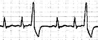 Стоп-инфаркт. Как читать ЭКГ и заботиться о сердце Стоп-инфаркт. Как читать ЭКГ и заботиться о сердце