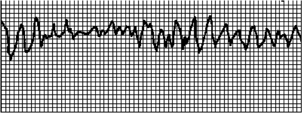 Стоп-инфаркт. Как читать ЭКГ и заботиться о сердце Стоп-инфаркт. Как читать ЭКГ и заботиться о сердце