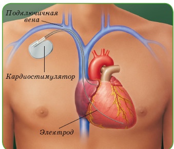 Энциклопедия диагностики и лечения от А до Я Энциклопедия диагностики и лечения от А до Я