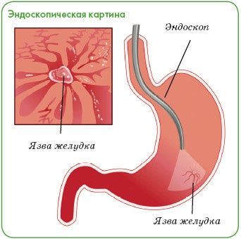 Энциклопедия диагностики и лечения от А до Я Энциклопедия диагностики и лечения от А до Я