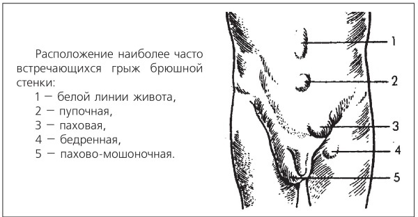 Болезни от А до Я. Традиционное и нетрадиционное лечение