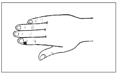 Болезни от А до Я. Традиционное и нетрадиционное лечение