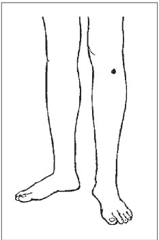 Болезни от А до Я. Традиционное и нетрадиционное лечение Болезни от А до Я. Традиционное и нетрадиционное лечение