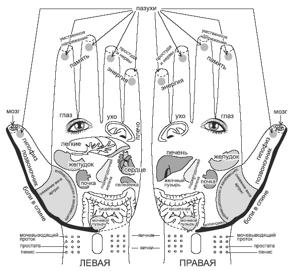 Жизнь после инсульта Жизнь после инсульта