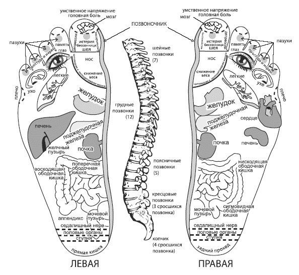 Жизнь после инсульта Жизнь после инсульта