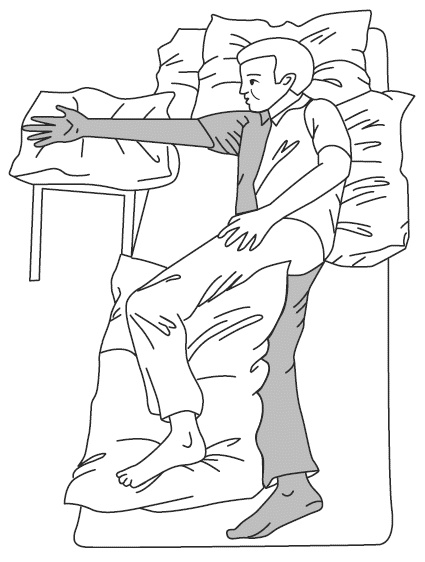 Жизнь после инсульта Жизнь после инсульта