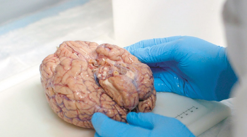 Мозг. Ваша личная история Мозг. Ваша личная история