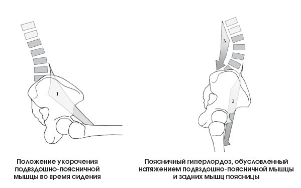 Диагностика и лечение позвоночника. Уникальная система доктора А. М. Уриа Диагностика и лечение позвоночника. Уникальная система доктора А. М. Уриа