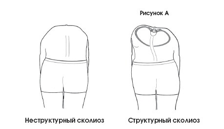 Диагностика и лечение позвоночника. Уникальная система доктора А. М. Уриа Диагностика и лечение позвоночника. Уникальная система доктора А. М. Уриа