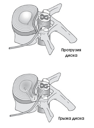 Диагностика и лечение позвоночника. Уникальная система доктора А. М. Уриа Диагностика и лечение позвоночника. Уникальная система доктора А. М. Уриа