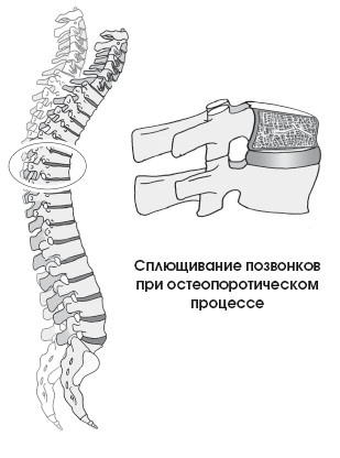 Диагностика и лечение позвоночника. Уникальная система доктора А. М. Уриа Диагностика и лечение позвоночника. Уникальная система доктора А. М. Уриа