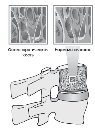 Диагностика и лечение позвоночника. Уникальная система доктора А. М. Уриа Диагностика и лечение позвоночника. Уникальная система доктора А. М. Уриа