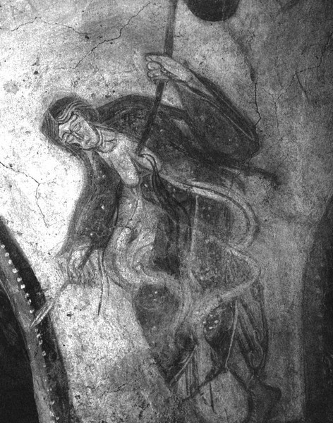 История груди История груди