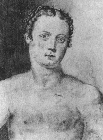 История груди История груди