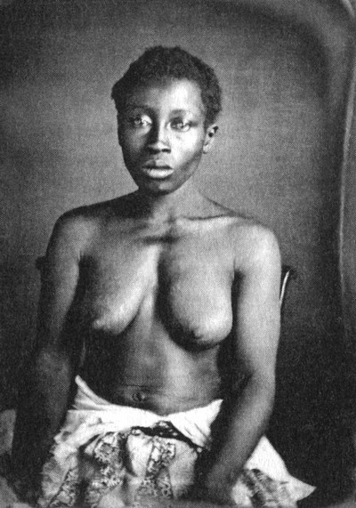 История груди История груди