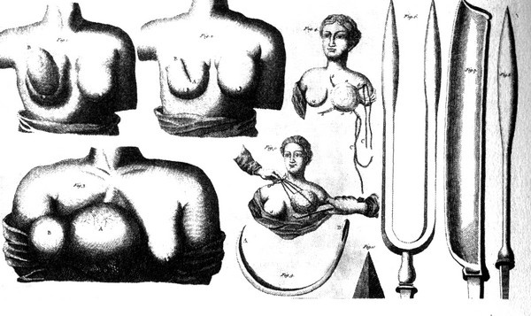 История груди История груди