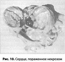 Психология стресса Психология стресса