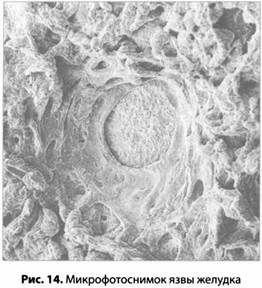 Психология стресса Психология стресса